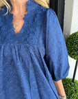 Women's Effortless Lace Dress